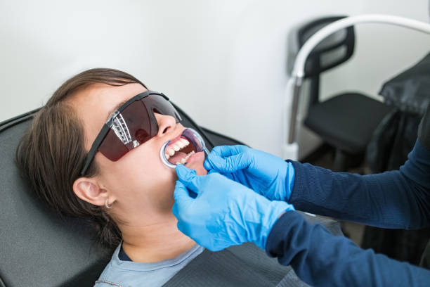 Best Knocked-Out Tooth (Avulsed Tooth) Treatment in Winchester, IL
